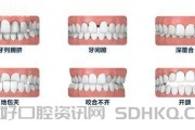 北极星牙齿矫正多少钱、常州钟楼区 / 新北区 / 天宁区 / 武进区 / 金坛区 / 溧阳市正畸